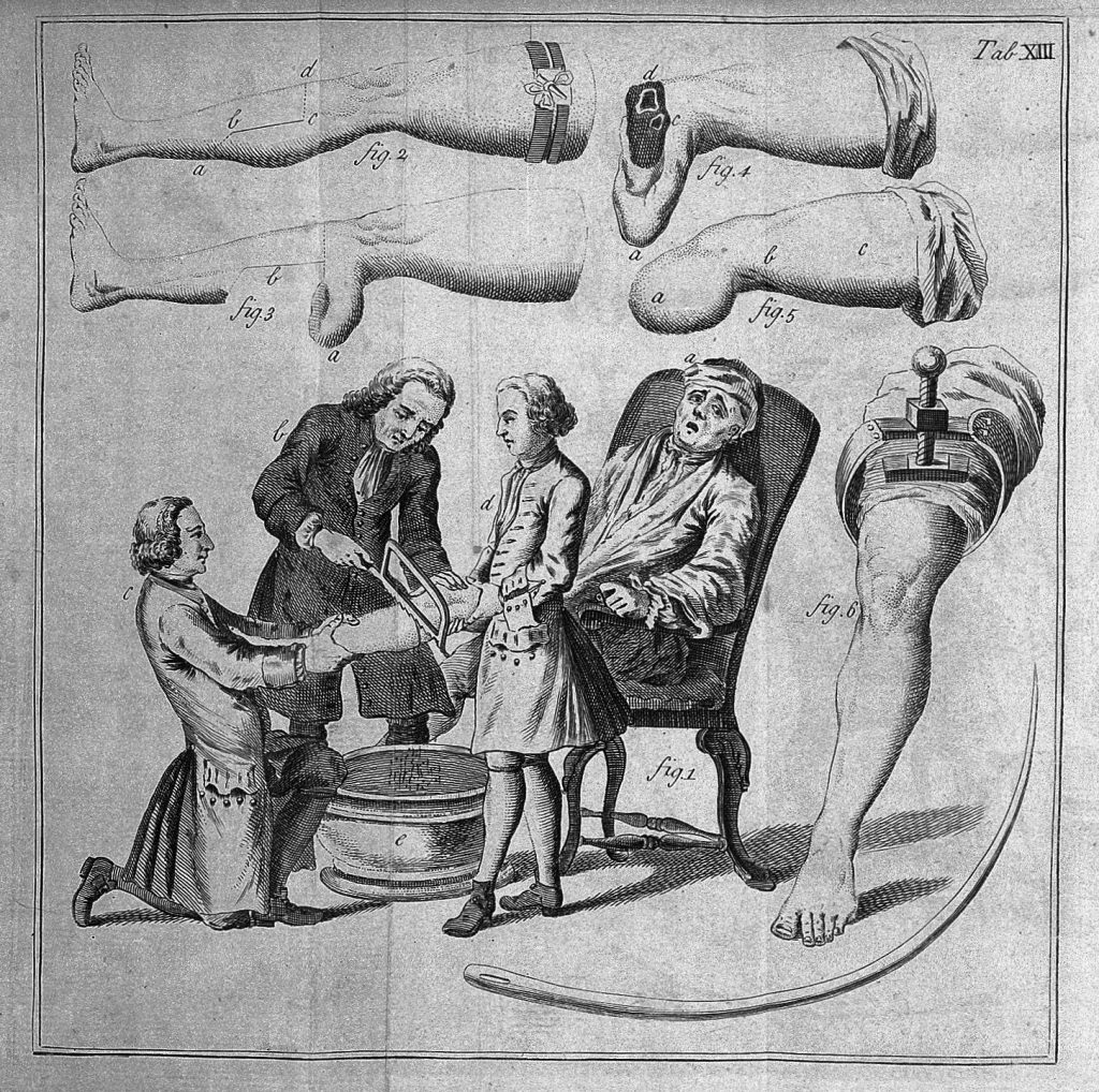 By http://wellcomeimages.org/indexplus/obf_images/0a/de/3ade5d276701faa36a632310c0f4.jpgGallery: http://wellcomeimages.org/indexplus/image/L0029965.html, CC BY 4.0, Link