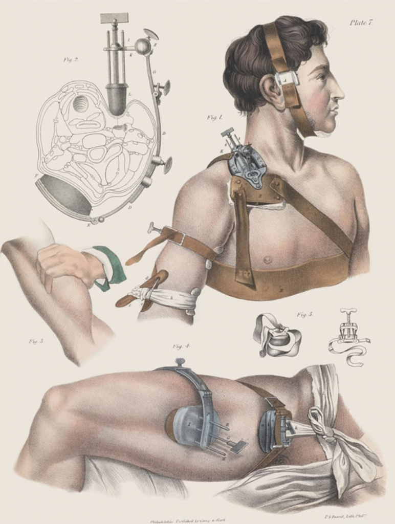 viktoriánska medicína