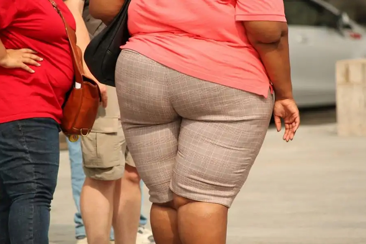 obezita