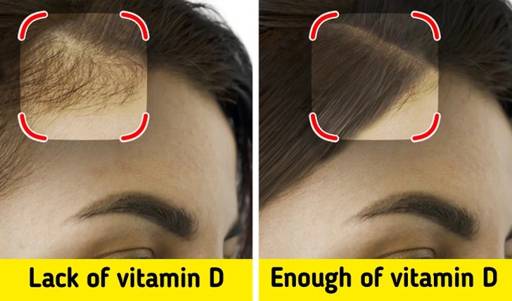 vitamín D