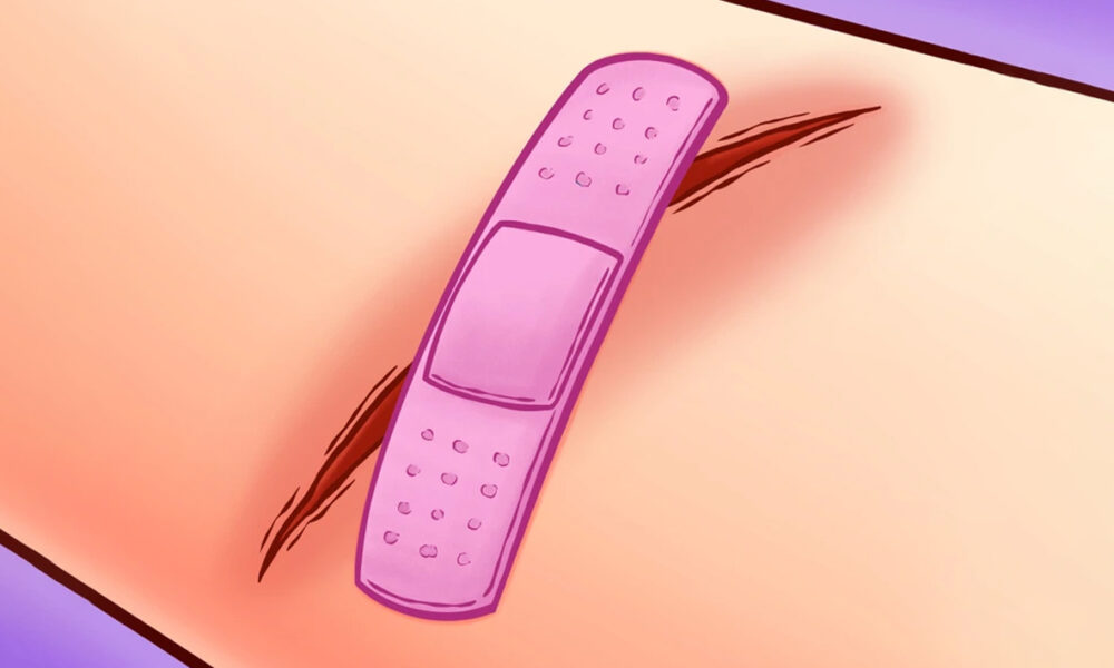 prediabetes
