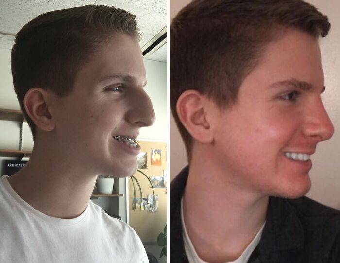 Plastické operácie