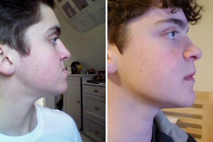 Plastické operácie