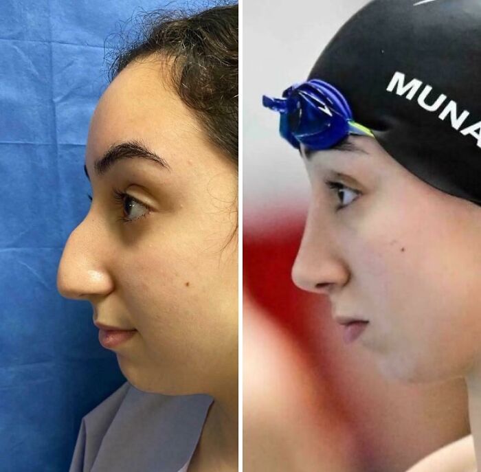 Plastické operácie