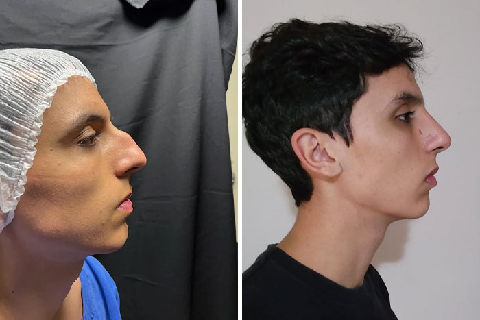 Plastické operácie