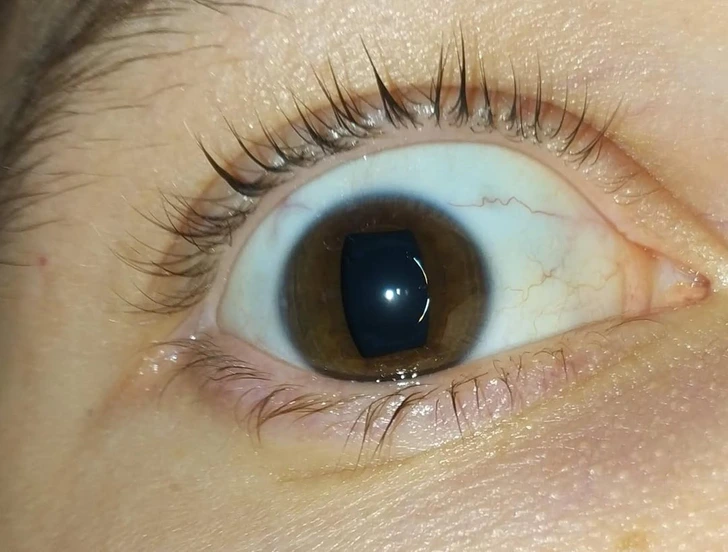 Neuveriteľné zábery