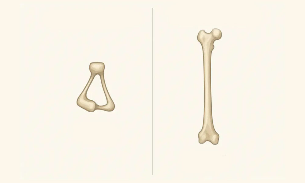 kosť