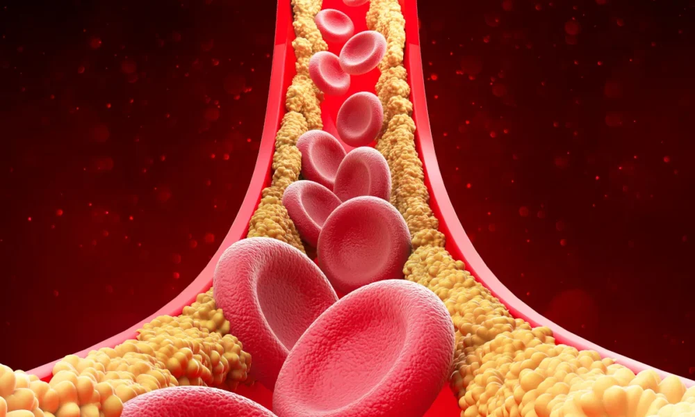 cholesterol