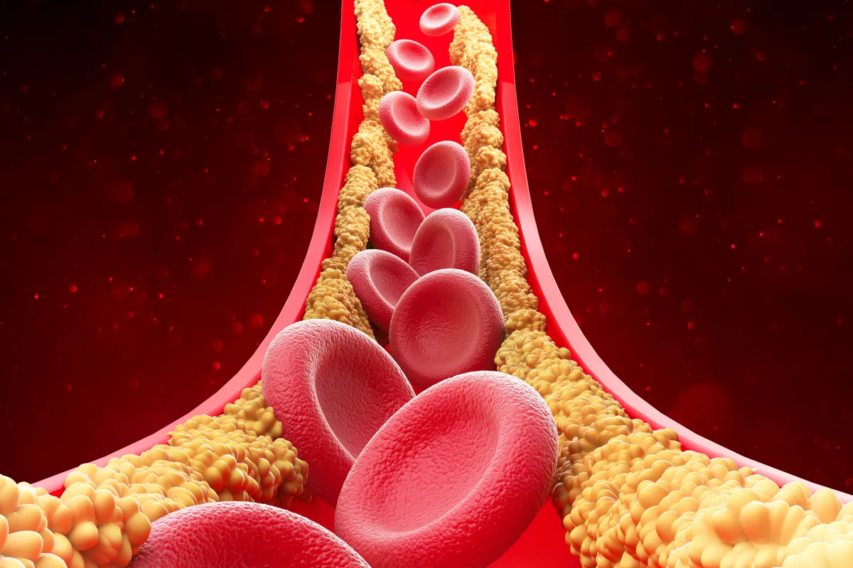 cholesterol