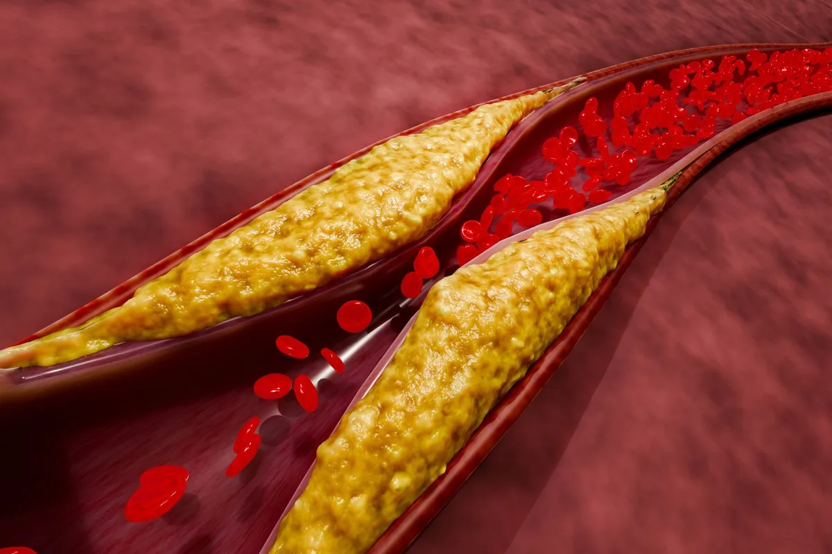 cholesterol