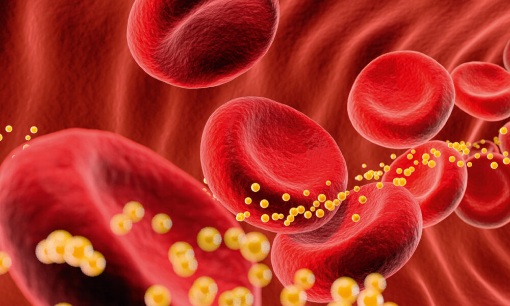 prirodzené zníženie cholesterolu
